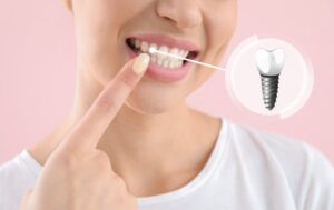 Woman smiling and pointing to her dental implants